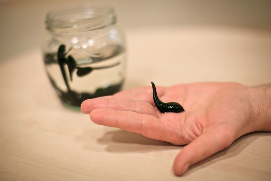 Leeches are used as raw materials for the production of a cream that stimulates penis growth